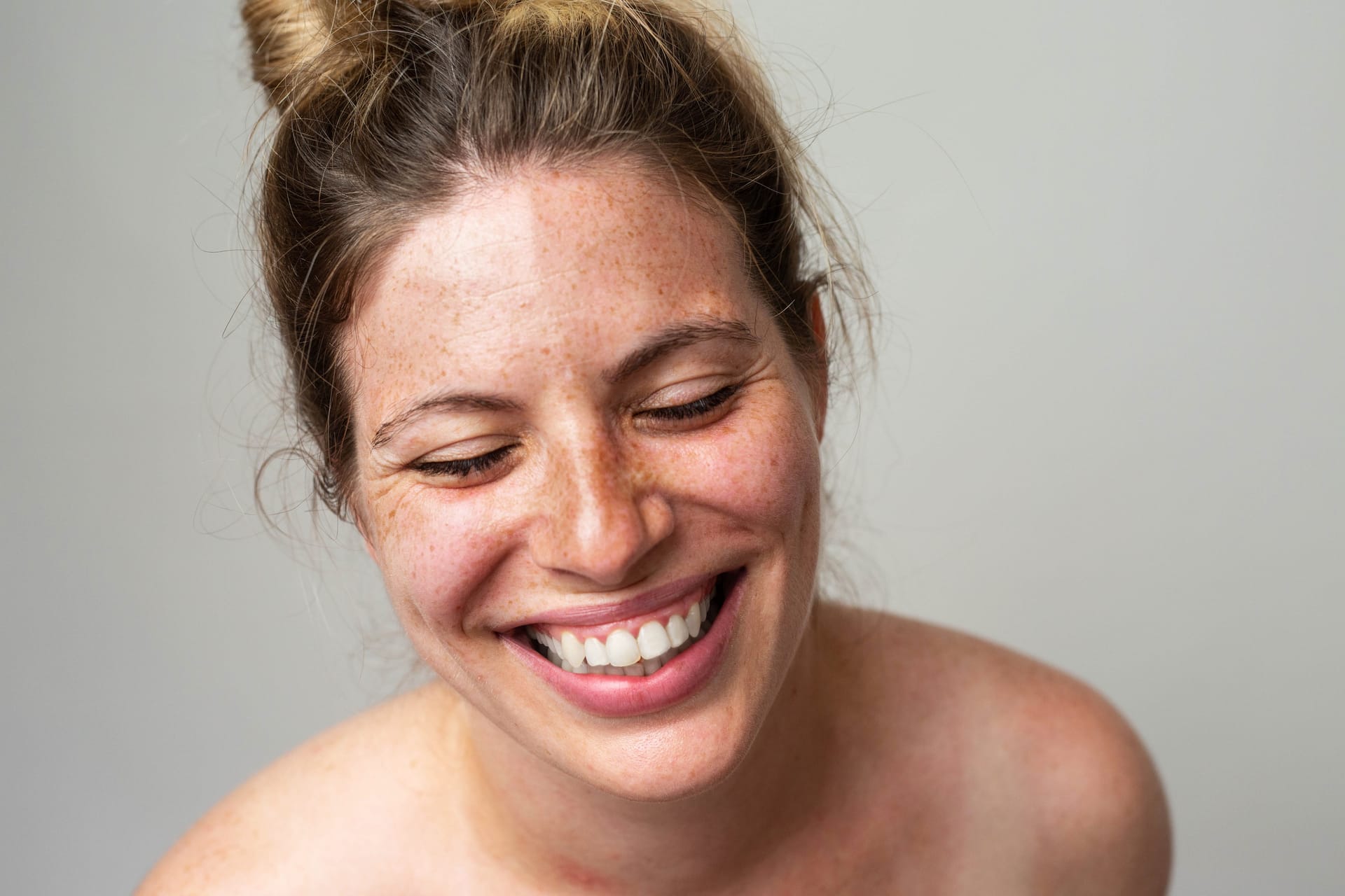 Female Hair Loss Treatment